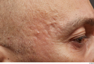 Photos Gabriel Ocampo HD Face skin references forehead pores skin…
